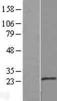 MOSPD1 Protein - Western validation with an anti-DDK antibody * L: Control HEK293 lysate R: Over-expression lysate