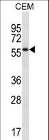 MOSPD2 Antibody - MOSPD2 Antibody (N-term ) western blot of CEM cell line lysates (35 ug/lane). The MOSPD2 antibody detected the MOSPD2 protein (arrow).