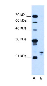 MOSPD3 Antibody - MOSPD3 antibody ARP44910_T100-NP_001035188-MOSPD3(motile sperm domain containing 3) Antibody Western blot of Jurkat lysate.  This image was taken for the unconjugated form of this product. Other forms have not been tested.