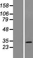 MOSPD3 Protein - Western validation with an anti-DDK antibody * L: Control HEK293 lysate R: Over-expression lysate