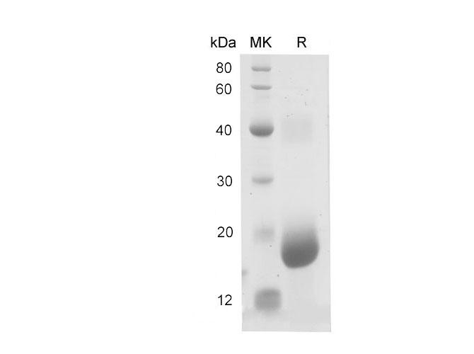 15-PGDH / HPGD Protein - Recombinant Mouse Hpgd protein (His Tag)