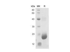 15-PGDH / HPGD Protein - Recombinant Mouse Hpgd protein (His Tag)