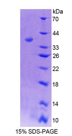 AANAT Protein - Recombinant Arylalkylamine-N-Acetyltransferase By SDS-PAGE