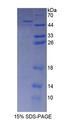 AASS / LKR / SDH Protein - Recombinant  Aminoadipate Semialdehyde Synthase By SDS-PAGE