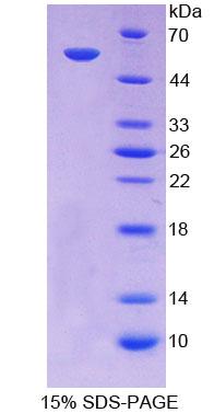 ABCA13 Protein - Recombinant  ATP Binding Cassette TransPorter A13 By SDS-PAGE