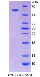 ABCA13 Protein - Recombinant  ATP Binding Cassette TransPorter A13 By SDS-PAGE