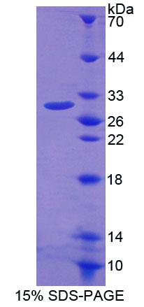 ABCA2 Protein - Recombinant ATP Binding Cassette Transporter A2 (ABCA2) by SDS-PAGE
