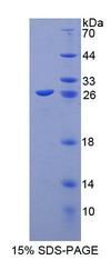 ABCA8 Protein - Recombinant ATP Binding Cassette Transporter A8 (ABCA8) by SDS-PAGE