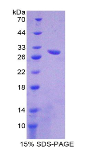 ABCB11 / BSEP Protein - Recombinant ATP Binding Cassette Transporter B11 By SDS-PAGE