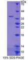ABCB7 Protein - Recombinant ATP Binding Cassette Transporter B7 (ABCB7) by SDS-PAGE
