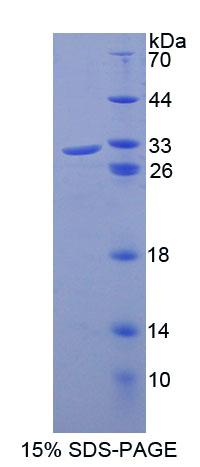 ABCB8 Protein - Recombinant ATP Binding Cassette Transporter B8 (ABCB8) by SDS-PAGE