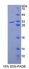 ABCB8 Protein - Recombinant ATP Binding Cassette Transporter B8 (ABCB8) by SDS-PAGE