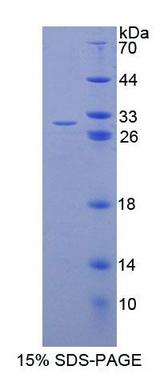 ABCC11 / MRP8 Protein - Recombinant ATP Binding Cassette Transporter C11 (ABCC11) by SDS-PAGE