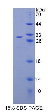 ABCC6 / MRP6 Protein - Recombinant ATP Binding Cassette Transporter C6 (ABCC6) by SDS-PAGE