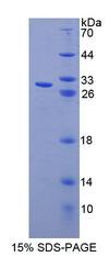 ABCF1 Protein - Recombinant ATP Binding Cassette Transporter F1 (ABCF1) by SDS-PAGE
