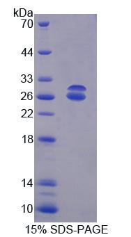 ABCG5 Protein - Recombinant ATP Binding Cassette Transporter G5 (ABCG5) by SDS-PAGE