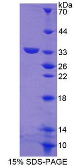 ABCG8 Protein - Recombinant ATP Binding Cassette Transporter G8 (ABCG8) by SDS-PAGE