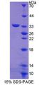 ABCG8 Protein - Recombinant ATP Binding Cassette Transporter G8 (ABCG8) by SDS-PAGE