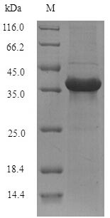 ABHD11 Protein - (Tris-Glycine gel) Discontinuous SDS-PAGE (reduced) with 5% enrichment gel and 15% separation gel.