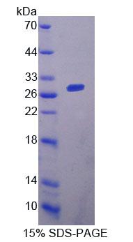 ACAA1 Protein - Recombinant Acetyl Coenzyme A Acyltransferase 1 (ACAA1) by SDS-PAGE