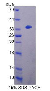 ACAA2 Protein - Recombinant Acetyl Coenzyme A Acyltransferase 2 (ACAA2) by SDS-PAGE