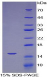 ACE / CD143 Protein