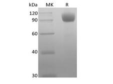 ACE2 / ACE-2 Protein - Recombinant Mouse Angiotensin-Converting Enzyme 2/ACE-2 (C-10His)