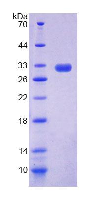 ACOX2 Protein - Recombinant Acyl Coenzyme A Oxidase 2, Branched (ACOX2) by SDS-PAGE