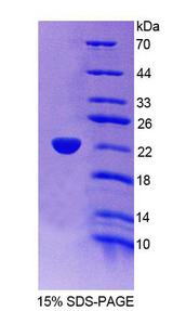 ACOX3 Protein - Recombinant Acyl Coenzyme A Oxidase 3, Pristanoyl (ACOX3) by SDS-PAGE