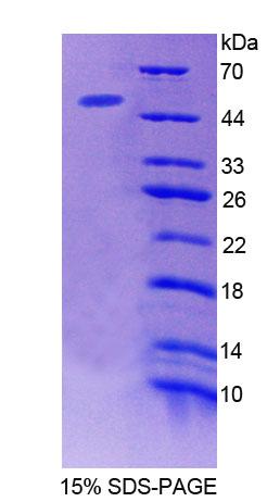 ACP6 Protein - Recombinant Acid Phosphatase 6, Lysophosphatidic (ACP6) by SDS-PAGE
