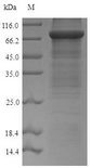 ACSS2 / ACAS2 Protein - (Tris-Glycine gel) Discontinuous SDS-PAGE (reduced) with 5% enrichment gel and 15% separation gel.
