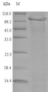 ADAMTS5 Protein - (Tris-Glycine gel) Discontinuous SDS-PAGE (reduced) with 5% enrichment gel and 15% separation gel.