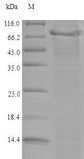 ADAMTS5 Protein - (Tris-Glycine gel) Discontinuous SDS-PAGE (reduced) with 5% enrichment gel and 15% separation gel.