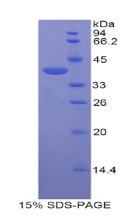 ADAP2 / CENTA2 Protein - Recombinant Centaurin Alpha 2 By SDS-PAGE