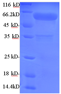 ADCK2 Protein