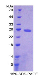 ADCY4 / Adenylate Cyclase 4 Protein - Recombinant Adenylate Cyclase 4 By SDS-PAGE