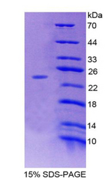 ADCY7 / Adenylate Cyclase 7 Protein - Recombinant  Adenylate Cyclase 7 By SDS-PAGE