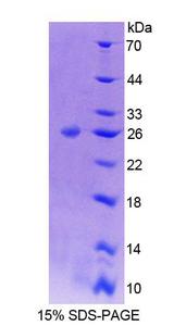ADD1 / Adducin Alpha Protein - Recombinant Adducin 1 By SDS-PAGE