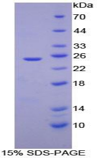 ADH1A / Alcohol Dehydrogenase Protein - Recombinant Alcohol Dehydrogenase 1 By SDS-PAGE