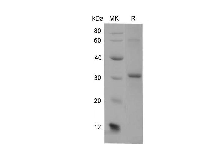 Adiponectin Protein - Recombinant Mouse ADIPOQ Protein (His Tag)