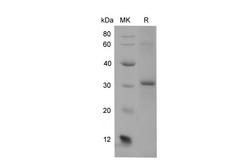 Adiponectin Protein - Recombinant Mouse ADIPOQ Protein (His Tag)