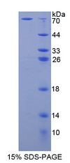 ADK / Adenosine Kinase Protein - Recombinant  Adenosine Kinase By SDS-PAGE