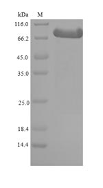 ADRBK1 / GRK2 Protein - (Tris-Glycine gel) Discontinuous SDS-PAGE (reduced) with 5% enrichment gel and 15% separation gel.