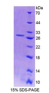 AFAP1 / AFAP Protein - Recombinant Actin Filament Associated Protein 1 By SDS-PAGE