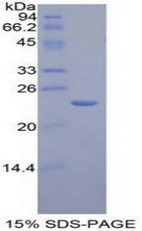 AGER / RAGE Protein - Recombinant Advanced Glycosylation End Product Specific Receptor By SDS-PAGE