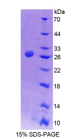 AGXT / SPT Protein - Recombinant Alanine Glyoxylate Aminotransferase By SDS-PAGE