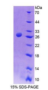 AGXT / SPT Protein - Recombinant Alanine Glyoxylate Aminotransferase By SDS-PAGE