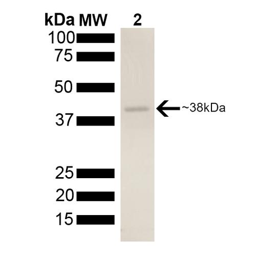 AHSA2 Protein - SDS-PAGE of ~38kDa his-tagged Aha2 protein.