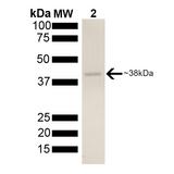 AHSA2 Protein - SDS-PAGE of ~38kDa his-tagged Aha2 protein.