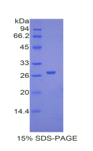AHSG / Fetuin A Protein - Recombinant Alpha-2-Heremans Schmid Glycoprotein By SDS-PAGE